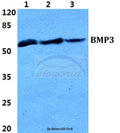 Western blot (WB) analysis of BMP3 polyclonal antibody at 1:500 dilution
Lane1:HEK293T cell lysate
Lane2:PC12 cell lysate
Lane3:H9C2 cell lysate