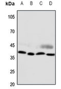Western blot (WB) analysis of CCRL2 polyclonal antibody at 1:500 dilution
LaneA:A375 whole cell lysate(30ug)
LaneB:H1688 whole cell lysate(30ug)
LaneC:The Spleen tissue lysate of Mouse(30ug)
LaneD:The Spleen tissue lysate of Rat(30ug)