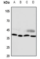 Western blot (WB) analysis of CCRL2 polyclonal antibody at 1:500 dilution
LaneA:A375 whole cell lysate(30ug)
LaneB:H1688 whole cell lysate(30ug)
LaneC:The Spleen tissue lysate of Mouse(30ug)
LaneD:The Spleen tissue lysate of Rat(30ug)