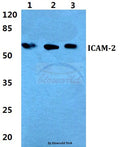 Western blot (WB) analysis of ICAM-2 polyclonal antibody at 1:500 dilution
Lane1:Hela cell lysate
Lane2:sp2/0 cell lysate
Lane3:PC12 cell lysate