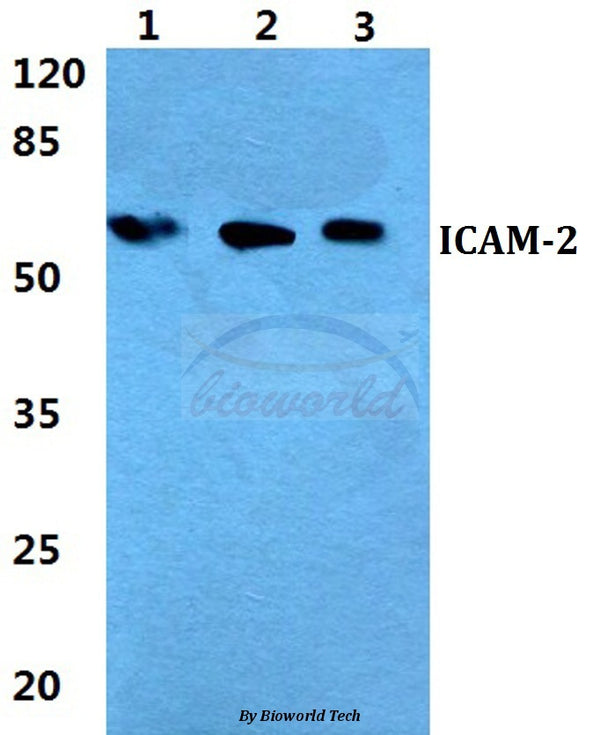 Western blot (WB) analysis of ICAM-2 polyclonal antibody at 1:500 dilution
Lane1:Hela cell lysate
Lane2:sp2/0 cell lysate
Lane3:PC12 cell lysate