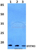 Western blot (WB) analysis of IFITM3 polyclonal antibody at 1:500 dilution
Lane1:HEK293T cell lysate
Lane2:Raw264.7 cell lysate
Lane3:H9C2 cell lysate