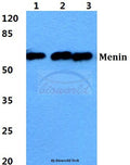 Western blot (WB) analysis of Menin polyclonal antibody at 1:500 dilution
Lane1:HEK293T cell lysate
Lane2:sp2/0 cell lysate
Lane3:H9C2 cell lysate