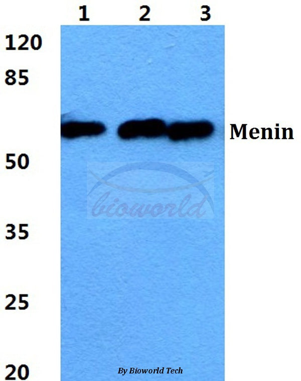 Western blot (WB) analysis of Menin polyclonal antibody at 1:500 dilution
Lane1:HEK293T cell lysate
Lane2:sp2/0 cell lysate
Lane3:H9C2 cell lysate