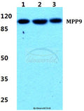 Western blot (WB) analysis of MPP9 polyclonal antibody at 1:500 dilution
Lane1:Hela cell lysate
Lane2:NIH-3T3 cell lysate
Lane3:PC12 cell lysate