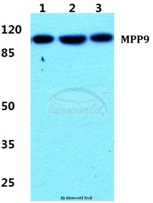 Western blot (WB) analysis of MPP9 polyclonal antibody at 1:500 dilution
Lane1:Hela cell lysate
Lane2:NIH-3T3 cell lysate
Lane3:PC12 cell lysate