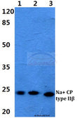 Western blot (WB) analysis of Na+ CP type IIβ polyclonal antibody at 1:500 dilution
Lane1:HEK29T cell lysate
Lane2:Raw264.7 cell lysate
Lane3:Rat liver tissue lysate