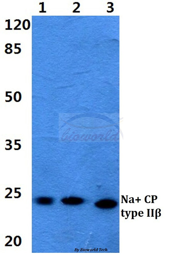 Western blot (WB) analysis of Na+ CP type IIβ polyclonal antibody at 1:500 dilution
Lane1:HEK29T cell lysate
Lane2:Raw264.7 cell lysate
Lane3:Rat liver tissue lysate