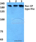 Western blot (WB) analysis of Na+ CP type IVα polyclonal antibody at 1:500 dilution
Lane1:MCF-7 cell lysate
Lane2:NIH-3T3 cell lysate
Lane3:H9C2 cell lysate