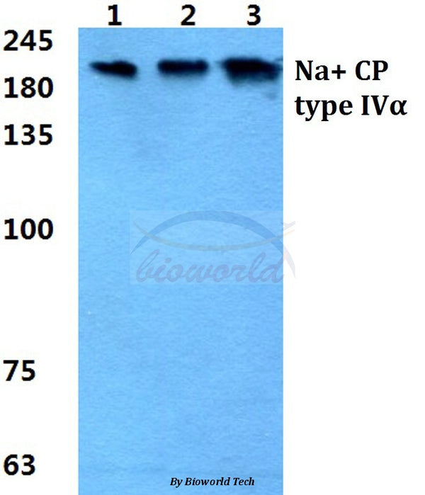 Western blot (WB) analysis of Na+ CP type IVα polyclonal antibody at 1:500 dilution
Lane1:MCF-7 cell lysate
Lane2:NIH-3T3 cell lysate
Lane3:H9C2 cell lysate