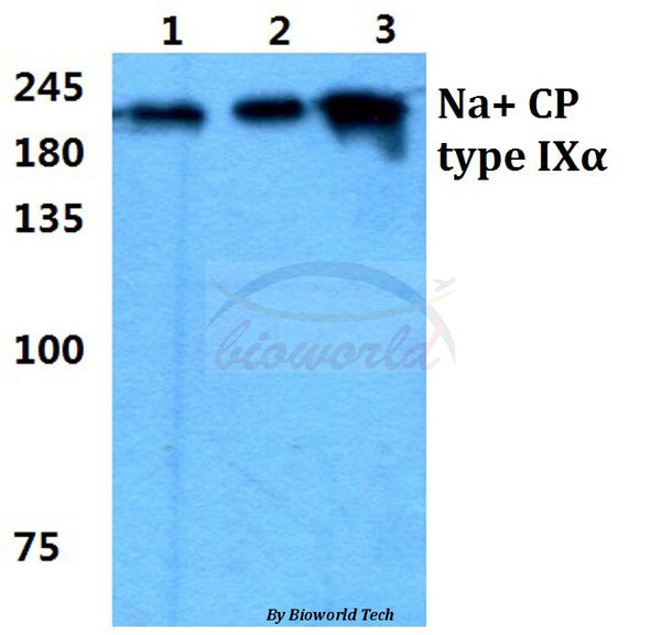 Western blot (WB) analysis of Na+ CP type IXα polyclonal antibody at 1:500 dilution
Lane1:MCF-7 cell lysate
Lane2:NIH-3T3 cell lysate
Lane3:H9C2 cell lysate