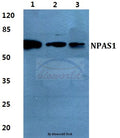 Western blot (WB) analysis of NPAS1 polyclonal antibody at 1:500 dilution
Lane1:HEK293T cell lysate
Lane2:Raw264.7 cell lysate
Lane3:Rat kidney tissue lysate