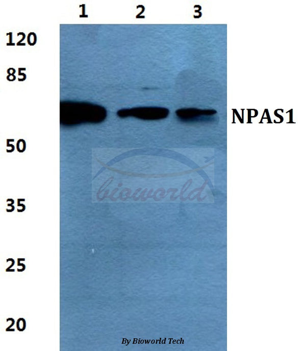 Western blot (WB) analysis of NPAS1 polyclonal antibody at 1:500 dilution
Lane1:HEK293T cell lysate
Lane2:Raw264.7 cell lysate
Lane3:Rat kidney tissue lysate