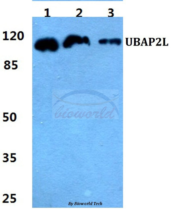 Western blot (WB) analysis of UBAP2L polyclonal antibody at 1:500 dilution
Lane1:MCF-7 cell lysate
Lane2:sp2/0 cell lysate
Lane3:H9C2 cell lysate