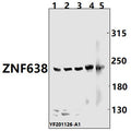 Western blot (WB) analysis of ZNF638 pAb at 1:500 dilution
Lane1:PC3 whole cell lysate(40ug)
Lane2:A549 whole cell lysate(40ug) 
Lane3:HEK293T whole cell lysate(40ug)
Lane4:The brain tissue lysate of Rat(40ug)
Lane5:The brain tissue lysate of Mouse(40ug)
