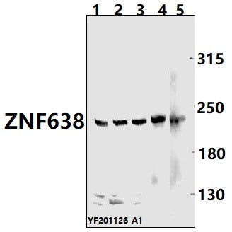 Western blot (WB) analysis of ZNF638 pAb at 1:500 dilution
Lane1:PC3 whole cell lysate(40ug)
Lane2:A549 whole cell lysate(40ug) 
Lane3:HEK293T whole cell lysate(40ug)
Lane4:The brain tissue lysate of Rat(40ug)
Lane5:The brain tissue lysate of Mouse(40ug)