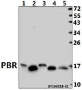 Western blot (WB) analysis of PBR pAb at 1:2000 dilution
Lane1:PMVEC whole cell lysate(40ug)
Lane2:HepG2 whole cell lysate(40ug)
Lane3:3T3-L1 whole cell lysate(40ug)
Lane4:A2780 whole cell lysate(40ug)
Lane5:A549 whole cell lysate(40ug)