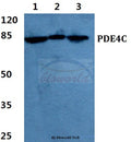 Western blot (WB) analysis of PDE4C polyclonal antibody at 1:500 dilution
Lane1:HEK293T cell lysate
Lane2:Mouse liver tissue lysate
Lane3:H9C2 cell lysate