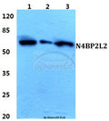 Western blot (WB) analysis of N4BP2L2 polyclonal antibody at 1:500 dilution
Lane1:MCF-7 cell lysate
Lane2:H9C2 cell lysate
Lane3:Rat lung tissue lysate