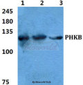 Western blot (WB) analysis of PHKB polyclonal antibody at 1:500 dilution
Lane1:Hela cell lysate
Lane2:sp2/0 cell lysate
Lane3:H9C2 cell lysate
