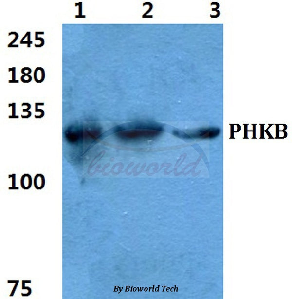 Western blot (WB) analysis of PHKB polyclonal antibody at 1:500 dilution
Lane1:Hela cell lysate
Lane2:sp2/0 cell lysate
Lane3:H9C2 cell lysate