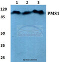 Western blot (WB) analysis of PMS1 polyclonal antibody at 1:500 dilution
Lane1:Hela cell lysate
Lane2:Raw264.7 cell lysate
Lane3:PC12 cell lysate