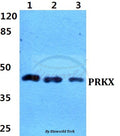 Western blot (WB) analysis of PRKX polyclonal antibody at 1:500 dilution
Lane1:HEK29T cell lysate
Lane2:sp2/0 cell lysate
Lane3:H9C2 cell lysate