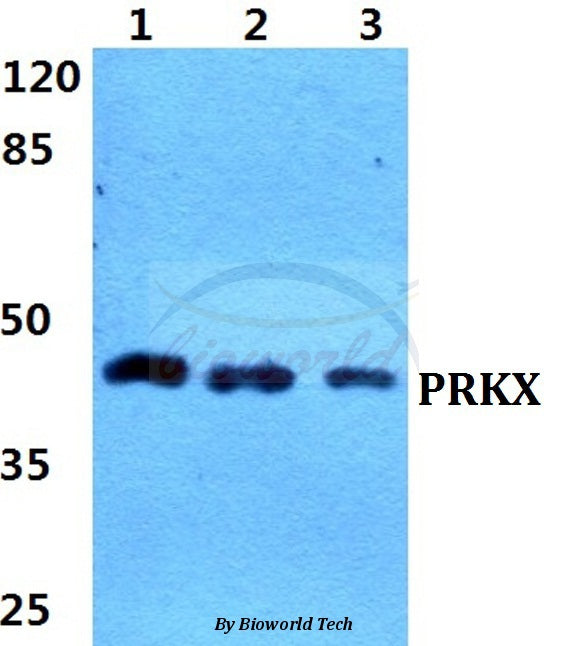Western blot (WB) analysis of PRKX polyclonal antibody at 1:500 dilution
Lane1:HEK29T cell lysate
Lane2:sp2/0 cell lysate
Lane3:H9C2 cell lysate