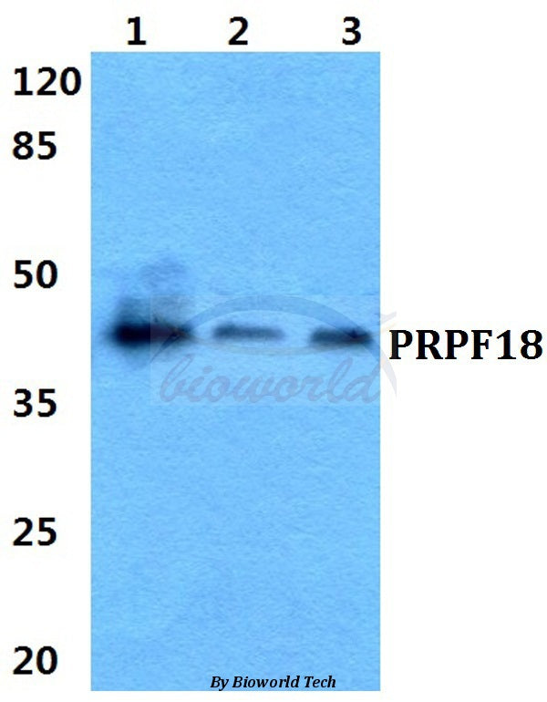 Western blot (WB) analysis of PRPF18 polyclonal antibody at 1:500 dilution
Lane1:HEK29T cell lysate
Lane2:sp2/0 cell lysate
Lane3:H9C2 cell lysate