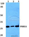 Western blot (WB) analysis of PRRX1 polyclonal antibody at 1:500 dilution
Lane1:HEK293T cell lysate
Lane2:Raw264.7 cell lysate
Lane3:H9C2 cell lyate