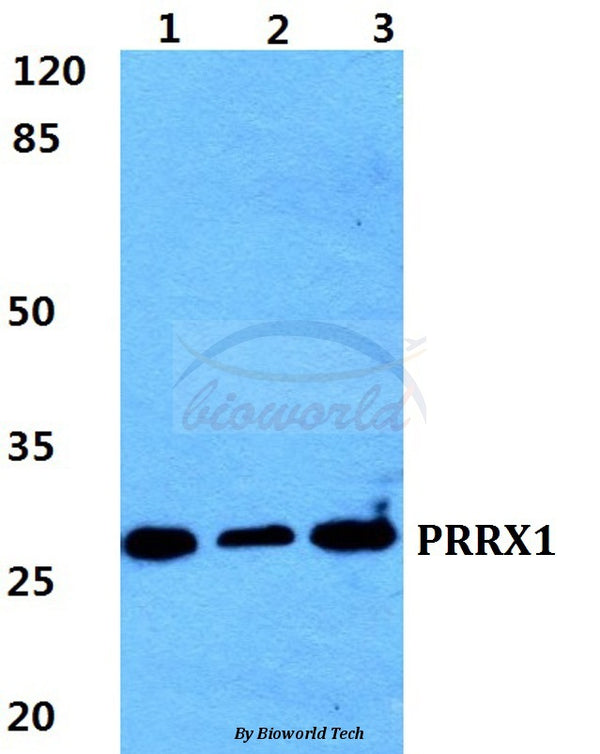 Western blot (WB) analysis of PRRX1 polyclonal antibody at 1:500 dilution
Lane1:HEK293T cell lysate
Lane2:Raw264.7 cell lysate
Lane3:H9C2 cell lyate