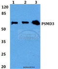 Western blot (WB) analysis of PSMD3 polyclonal antibody at 1:500 dilution
Lane1:HEK293T cell lysate
Lane2:Raw264.7 cell lysate
Lane3:PC12 cell lysate