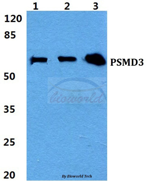 Western blot (WB) analysis of PSMD3 polyclonal antibody at 1:500 dilution
Lane1:HEK293T cell lysate
Lane2:Raw264.7 cell lysate
Lane3:PC12 cell lysate