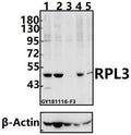 Western blot (WB) analysis of RPL3 polyclonal antibody at 1:500 dilution
Lane1:K562 whole cell lysate(40ug)
Lane2:A2780 whole cell lysate(40ug)
Lane3:SK-OVCAR3 whole cell lysate(40ug)
Lane4:HCT116 whole cell lysate(40ug)
Lane5:EC9706 whole cell lysate(40ug)