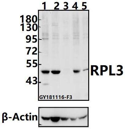 Western blot (WB) analysis of RPL3 polyclonal antibody at 1:500 dilution
Lane1:K562 whole cell lysate(40ug)
Lane2:A2780 whole cell lysate(40ug)
Lane3:SK-OVCAR3 whole cell lysate(40ug)
Lane4:HCT116 whole cell lysate(40ug)
Lane5:EC9706 whole cell lysate(40ug)