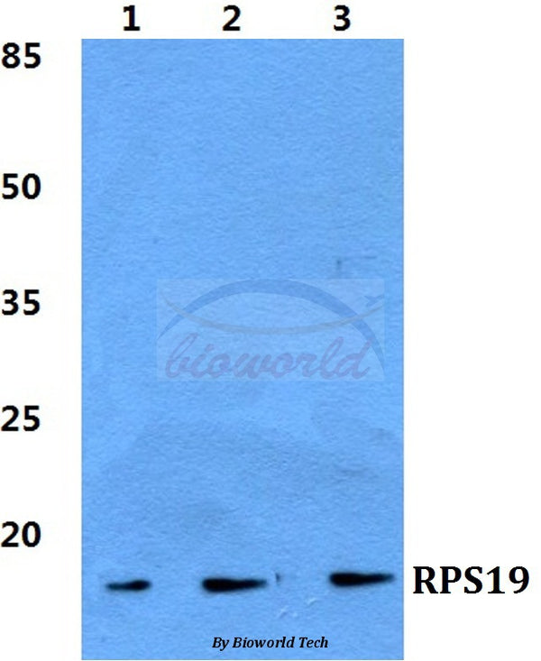 Western blot (WB) analysis of RPS19 polyclonal antibody at 1:500 dilution
Lane1:HEK293T cell lysate
Lane2:Raw264.7 cell lysate
Lane3:PC12 cell lysate