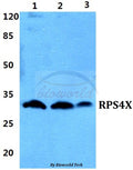 Western blot (WB) analysis of RPS4X polyclonal antibody at 1:500 dilution
Lane1:Hela cell lysate
Lane2:sp2/0 cell lysate
Lane3:H9C2 cell lysate