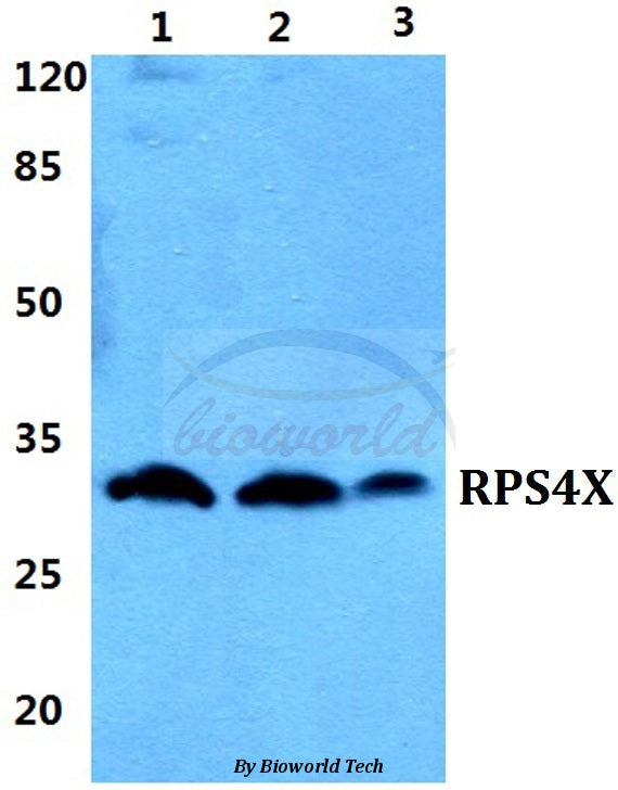 Western blot (WB) analysis of RPS4X polyclonal antibody at 1:500 dilution
Lane1:Hela cell lysate
Lane2:sp2/0 cell lysate
Lane3:H9C2 cell lysate