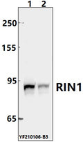 Western blot (WB) analysis of RIN1 pAb at 1:500 dilution
Lane1:U-87MG whole cell lysate(40ug)
Lane2:Panc1 whole cell lysate(40ug)