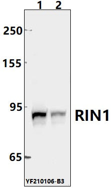 Western blot (WB) analysis of RIN1 pAb at 1:500 dilution
Lane1:U-87MG whole cell lysate(40ug)
Lane2:Panc1 whole cell lysate(40ug)