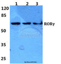 Western blot (WB) analysis of RORγ polyclonal antibody at 1:500 dilution
Lane1:Hela cell lysate
Lane2:sp2/0 cell lysate
Lane3:PC12 cell lysate