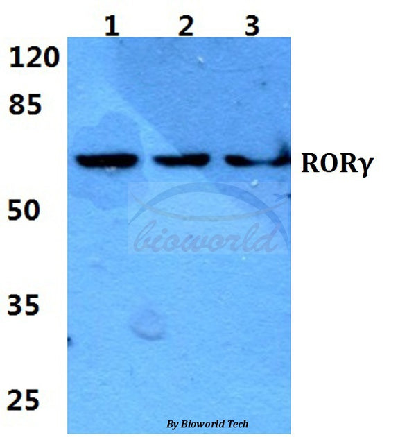 Western blot (WB) analysis of RORγ polyclonal antibody at 1:500 dilution
Lane1:Hela cell lysate
Lane2:sp2/0 cell lysate
Lane3:PC12 cell lysate