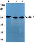 Western blot (WB) analysis of Septin 6 polyclonal antibody at 1:500 dilution
Lane1:Hela cell lysate
Lane2:sp2/0 cell lysate
Lane3:PC12 cell lysate