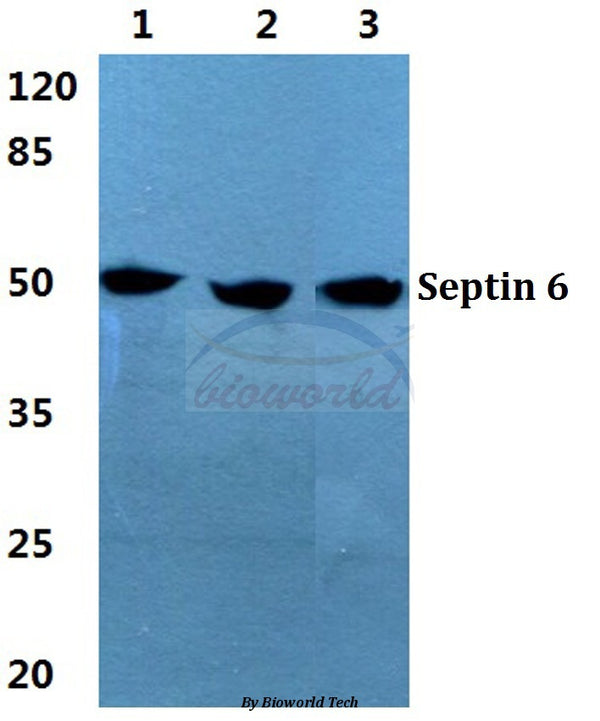 Western blot (WB) analysis of Septin 6 polyclonal antibody at 1:500 dilution
Lane1:Hela cell lysate
Lane2:sp2/0 cell lysate
Lane3:PC12 cell lysate