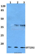 Western blot (WB) analysis of SFT2D2 polyclonal antibody at 1:500 dilution
Lane1:MCF-7 cell lysate
Lane2:Raw264.7 cell lysate
Lane3:PC12 cell lysate