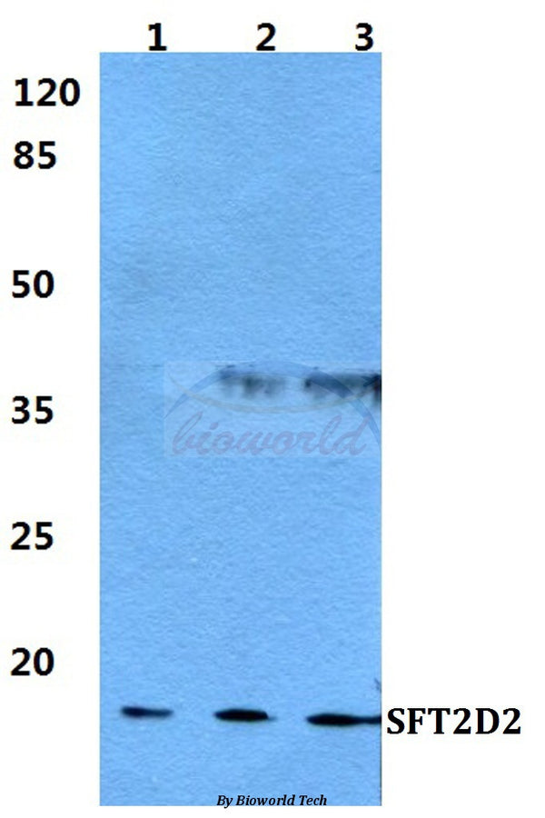 Western blot (WB) analysis of SFT2D2 polyclonal antibody at 1:500 dilution
Lane1:MCF-7 cell lysate
Lane2:Raw264.7 cell lysate
Lane3:PC12 cell lysate