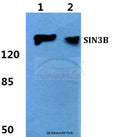 Western blot (WB) analysis of SIN3B polyclonal antibody at 1:500 dilution
Lane1:Hela cell lysate
Lane2:sp2/0 cell lysate