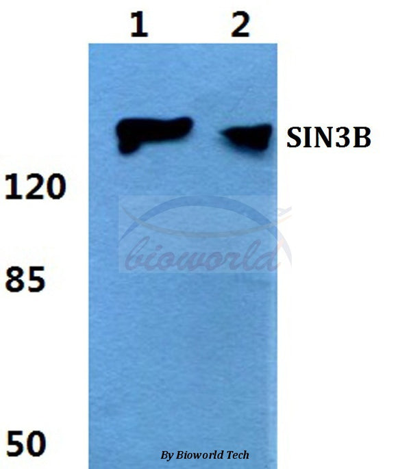 Western blot (WB) analysis of SIN3B polyclonal antibody at 1:500 dilution
Lane1:Hela cell lysate
Lane2:sp2/0 cell lysate