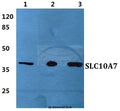 Western blot (WB) analysis of SLC10A7 polyclonal antibody at 1:500 dilution
Lane1:Hela cell lysate
Lane2:HEK293T cell lysate
Lane3:H9C2 cell lysate