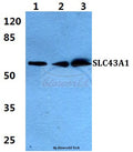 Western blot (WB) analysis of SLC43A1 polyclonal antibody at 1:500 dilution
Lane1:HEK293T cell lysate
Lane2:sp2/0 cell lysate
Lane3:H9C2 cell lysate